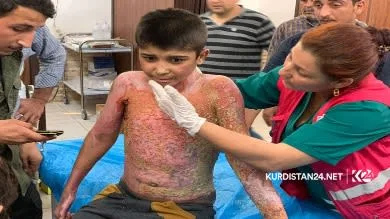 Kurdish boy who suffered burns from Turkish attack to receive treatment in France